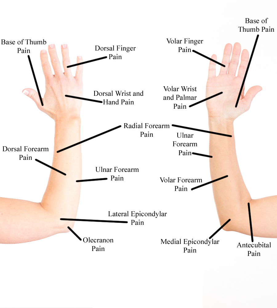 Forearm and Hand Pain