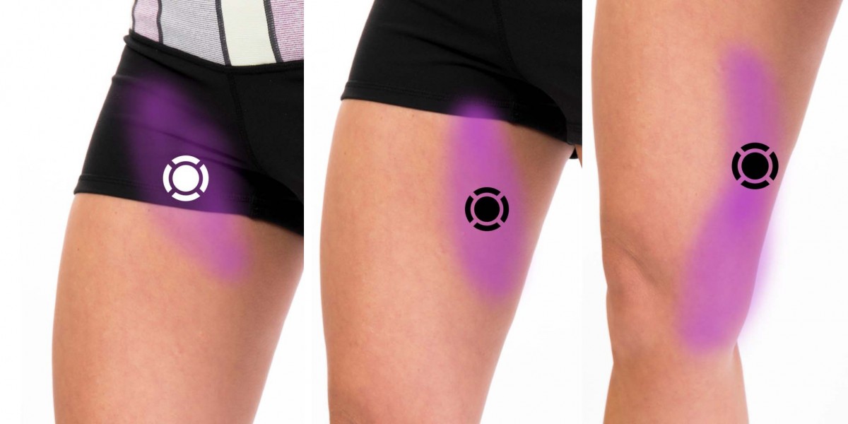 Anterior Thigh Pain Komizo Diagnostics