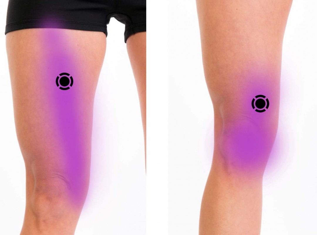 Medial Thigh – Komizo Diagnostics