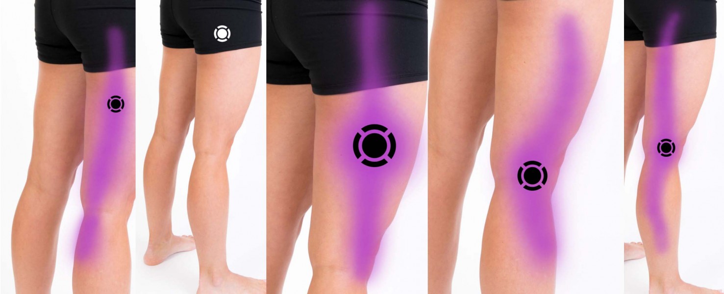 Anterior (Lateral) Thigh – Komizo Diagnostics